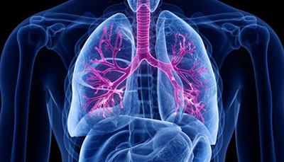 什么是慢性阻塞性肺病 (Chronic Obstructive Pulmonary Disease)，為何與新冠疫情有關(guān)？